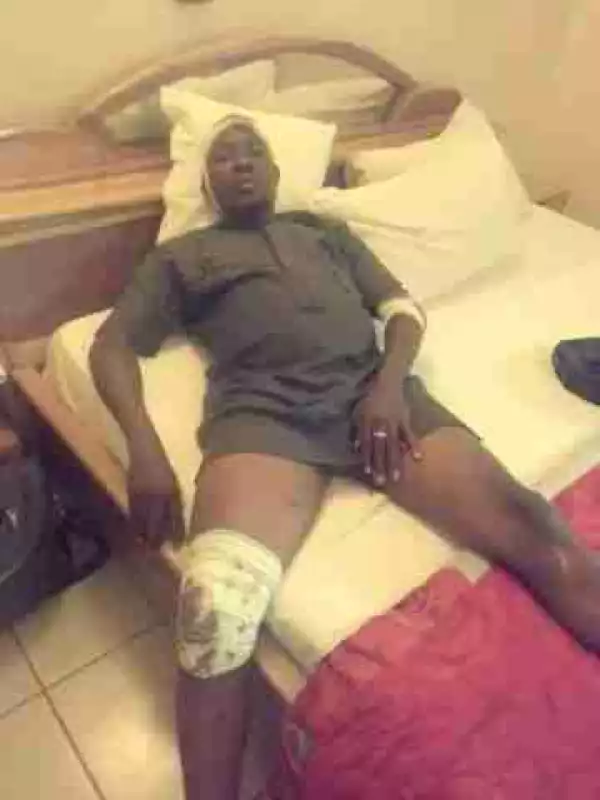"Kogi Lawmaker Faked Injuries From Thugs Attack" - Facebook User Claims With Photo